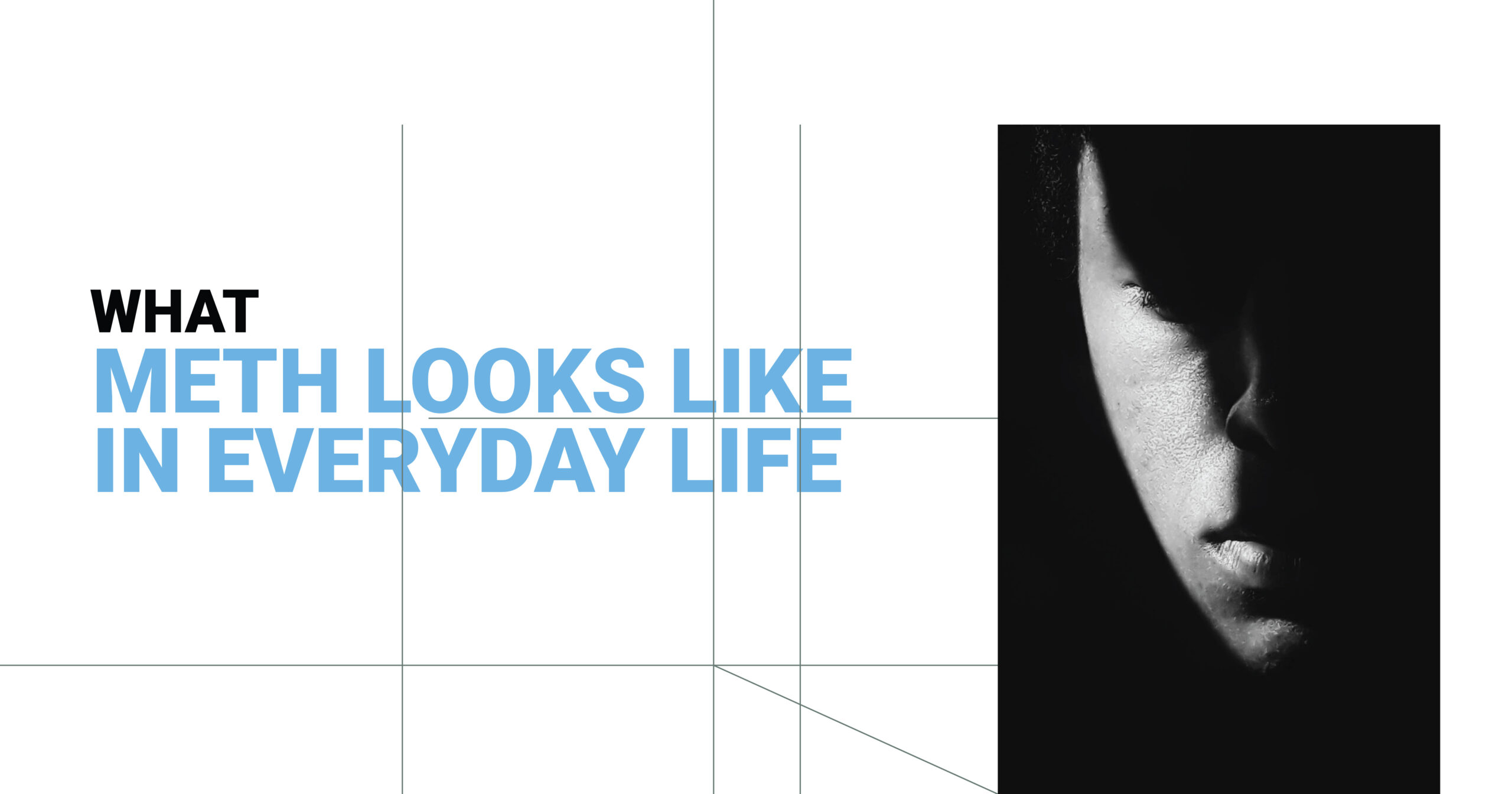 What Meth Looks Like: Image depicts the impact of meth addiction on a person's face, highlighting the effects of drug abuse.